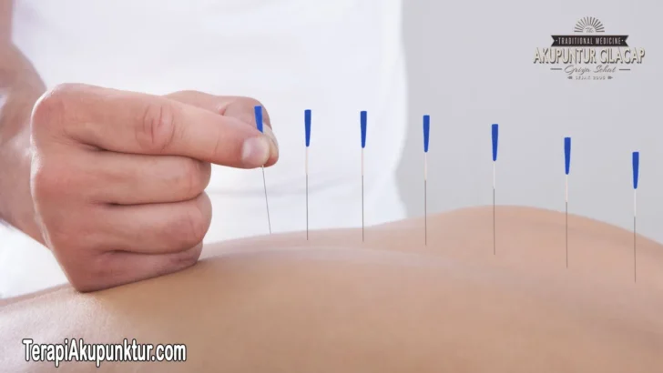 Akupunktur Panggilan Di Bekasi Timur