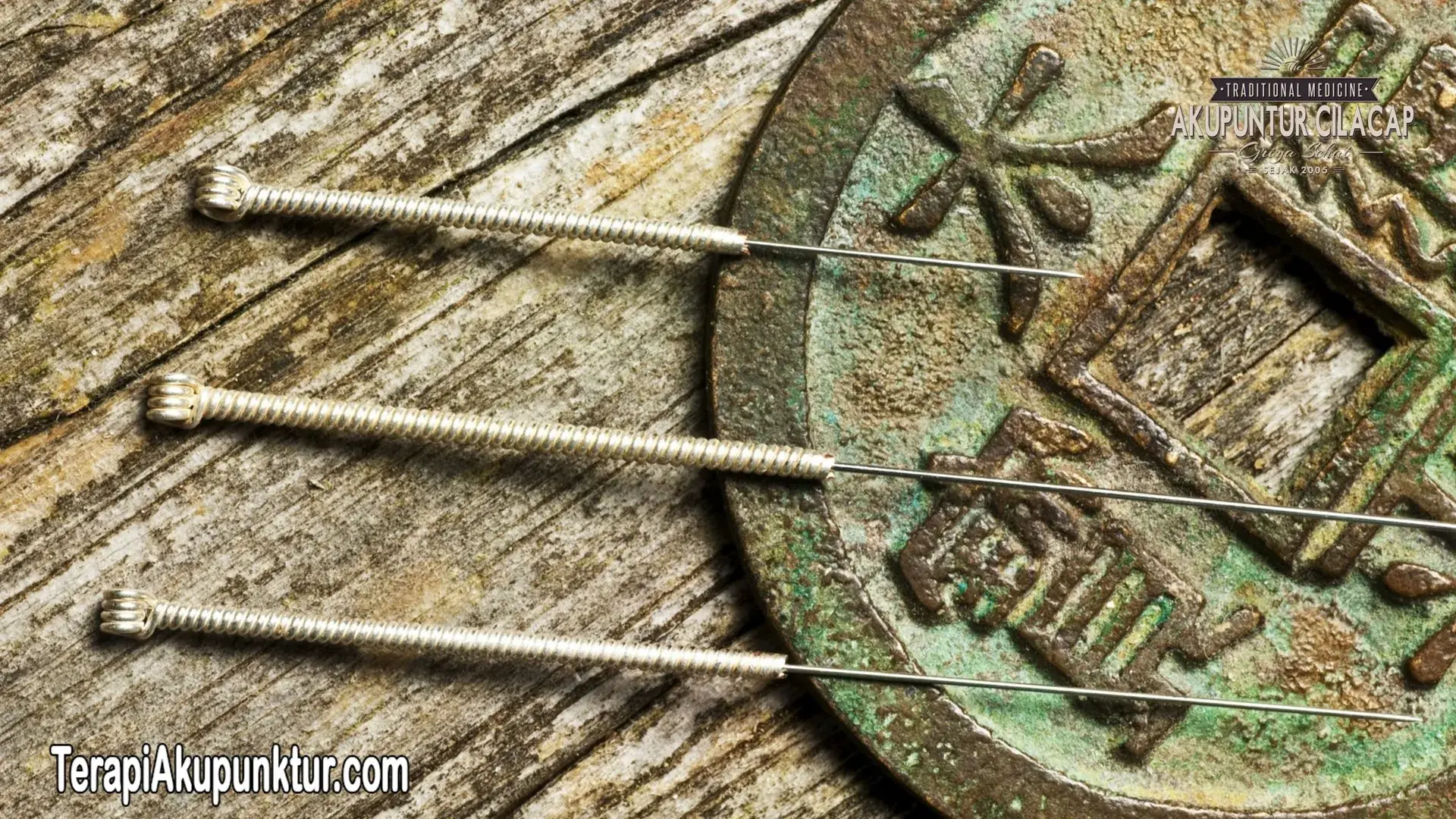 Akupunktur Untuk Kesemutan