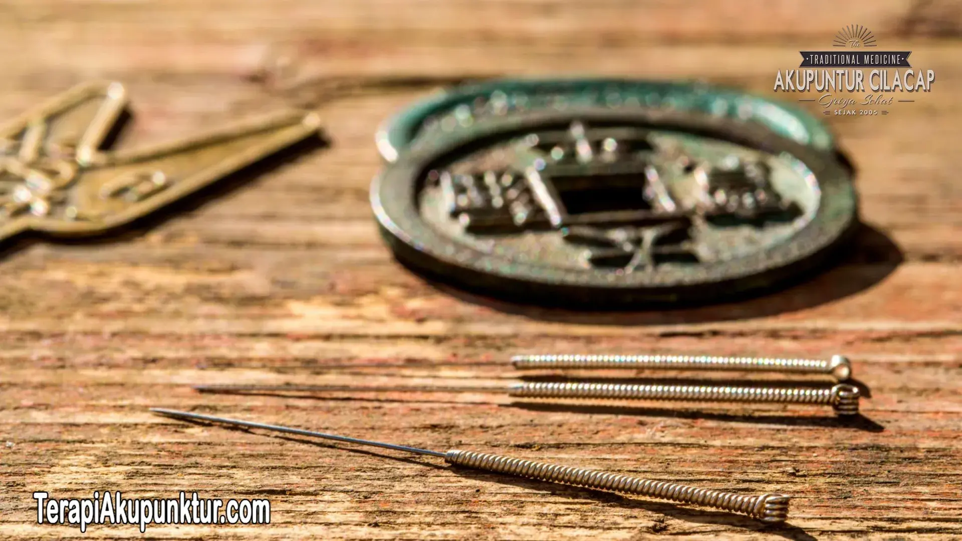 Akupunktur Untuk Migrain