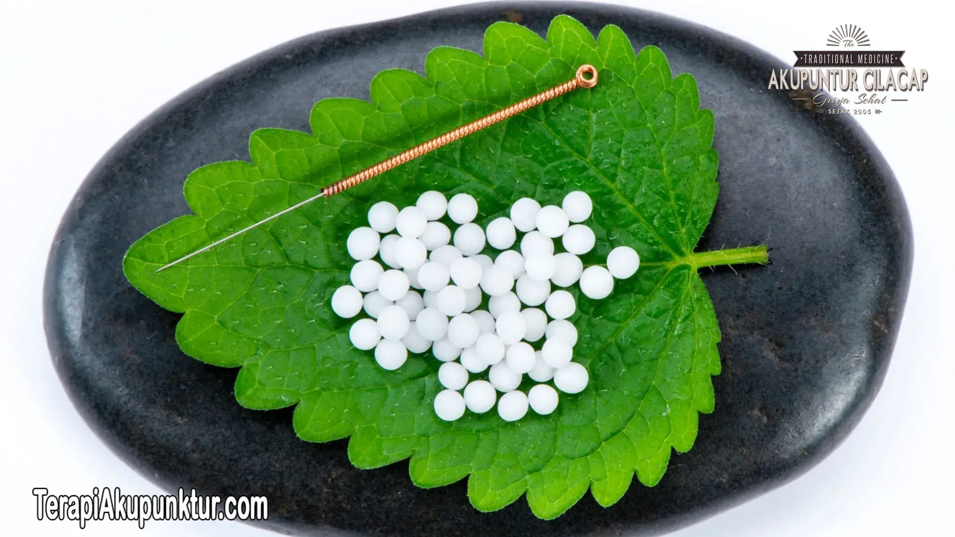 Akupunktur Untuk Miom