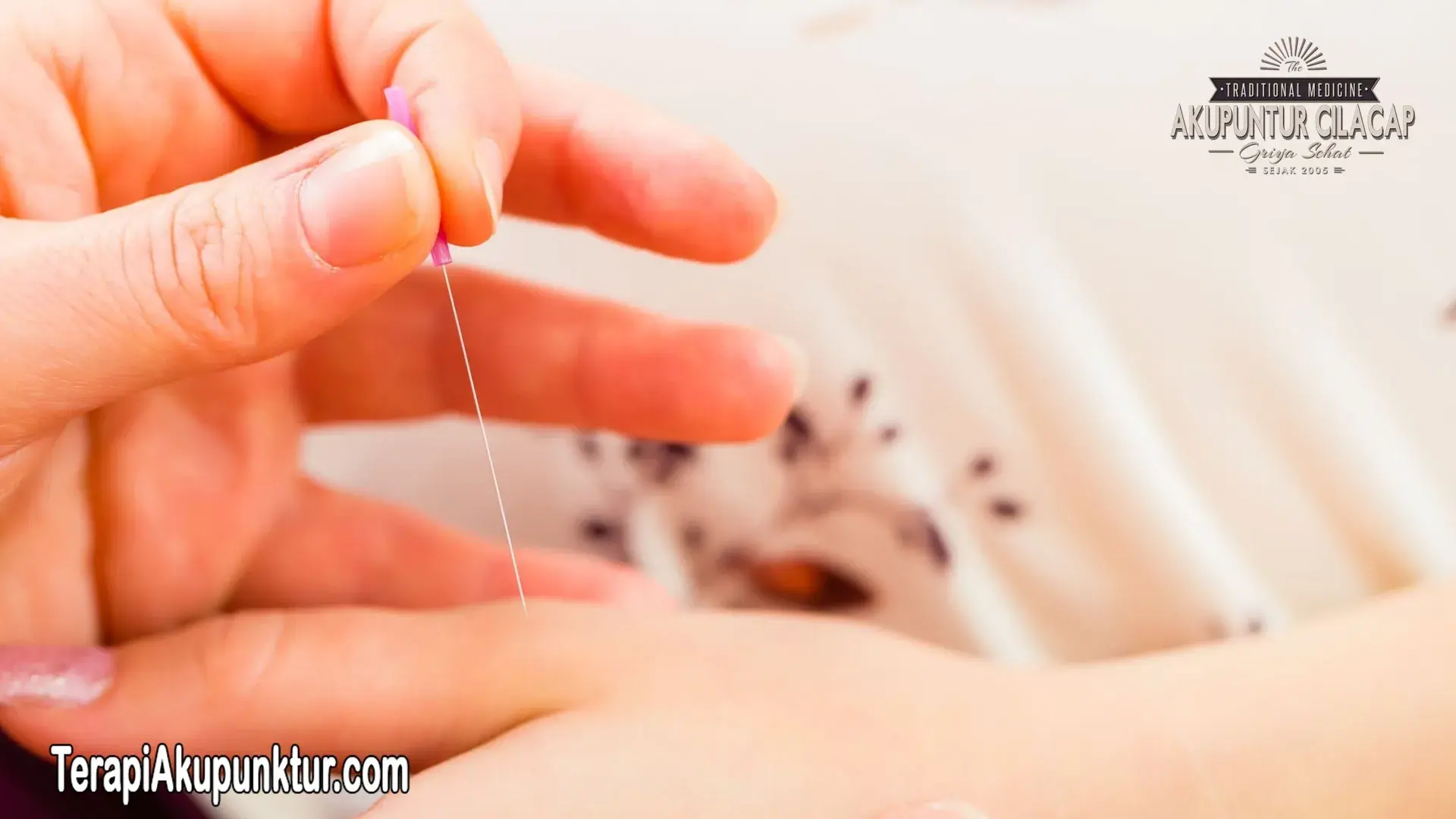 Apa itu Terapi Akupunktur