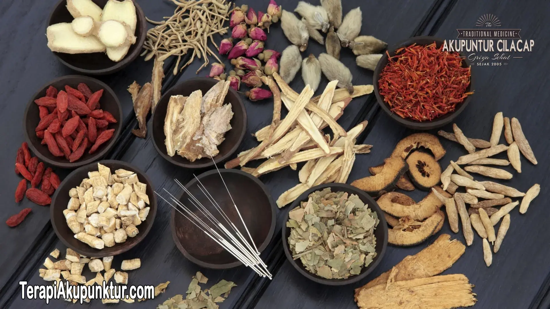 Mengenal Akupunktur untuk Mengatasi Nyeri