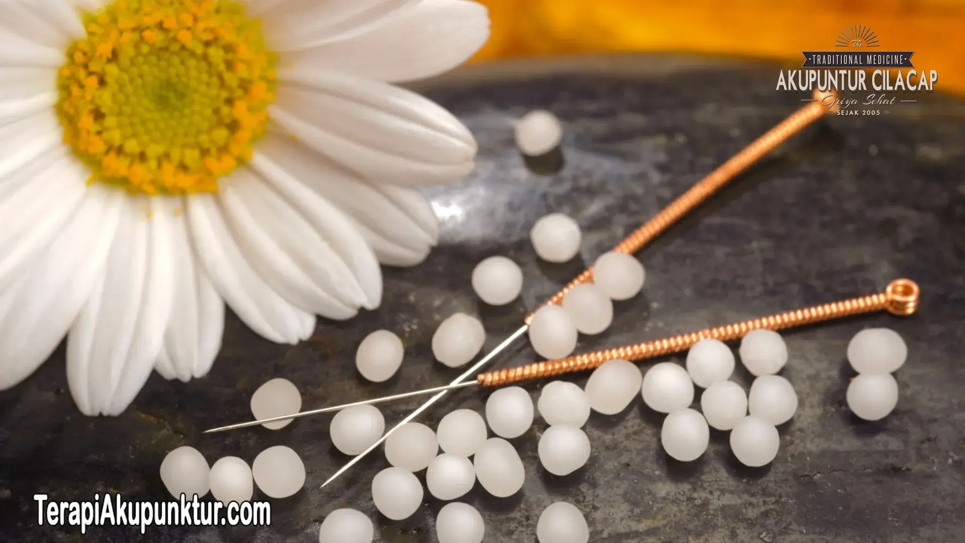 Terapi Akupunktur Program Hamil