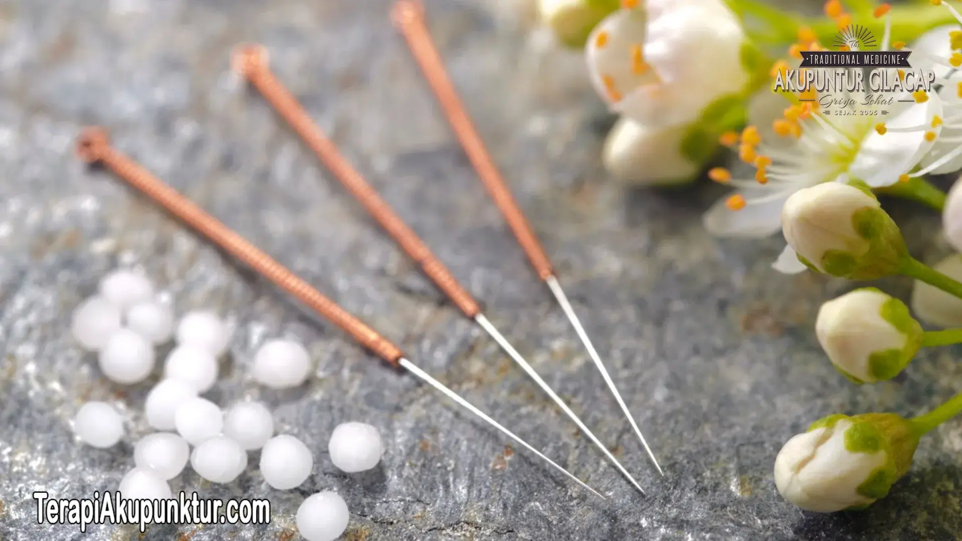 Akupunktur Untuk Kista