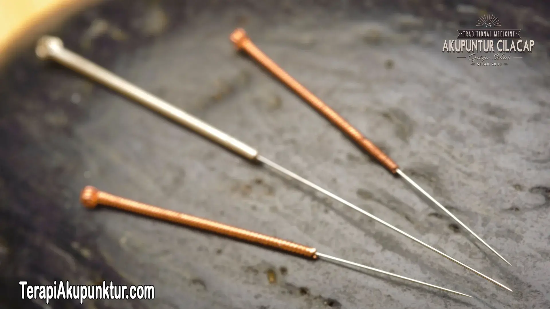 Terapi Akupunktur Untuk Kolesterol