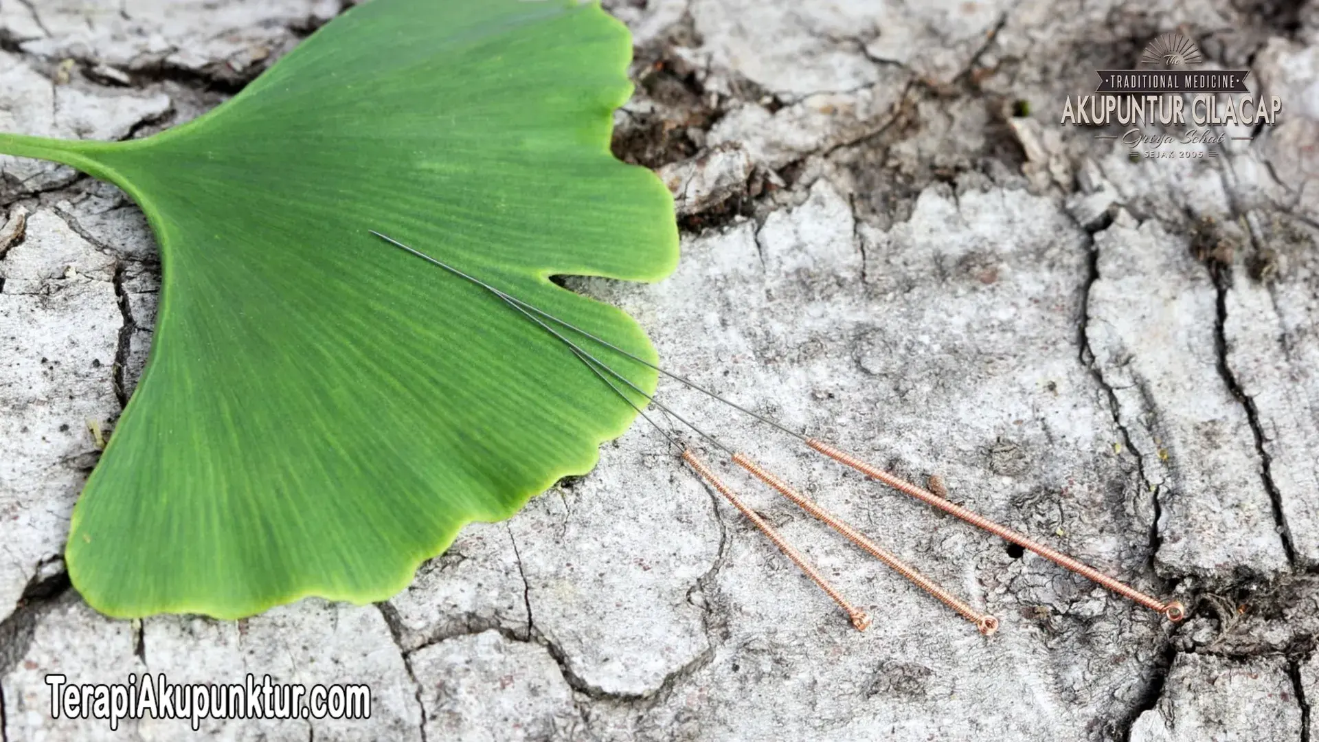 akupunktur untuk maag