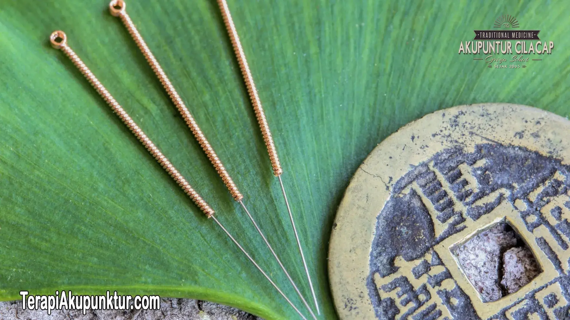 akupunktur untuk nyeri bahu